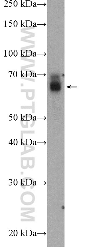 Western Blot (WB) analysis of pig brain tissue using KIAA0319 Polyclonal antibody (21927-1-AP)