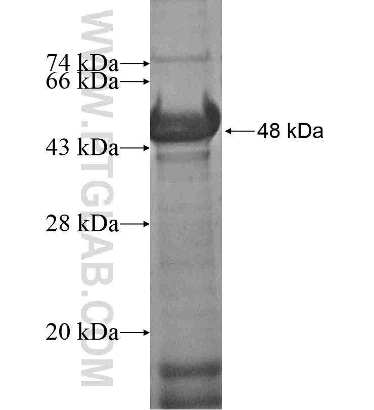KIAA0319 fusion protein Ag16493 SDS-PAGE