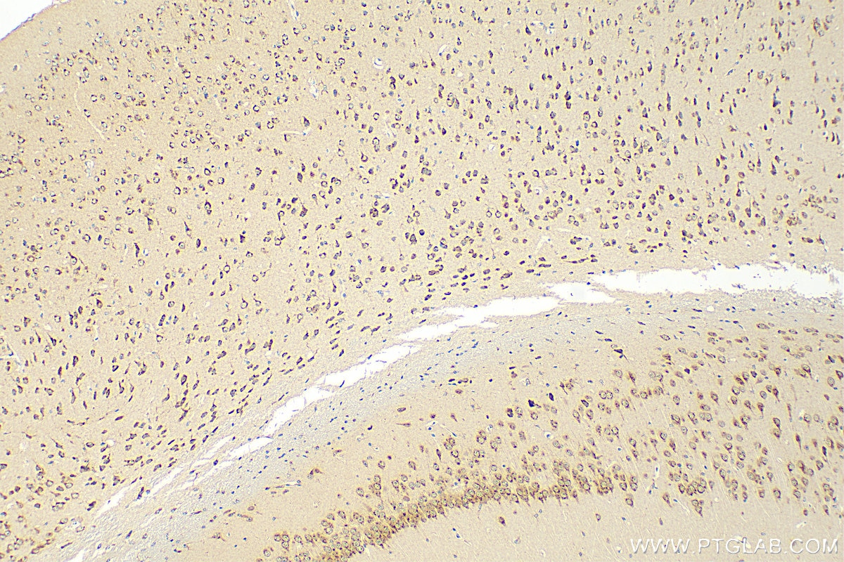 Immunohistochemistry (IHC) staining of mouse brain tissue using KIAA0319L Polyclonal antibody (21016-1-AP)