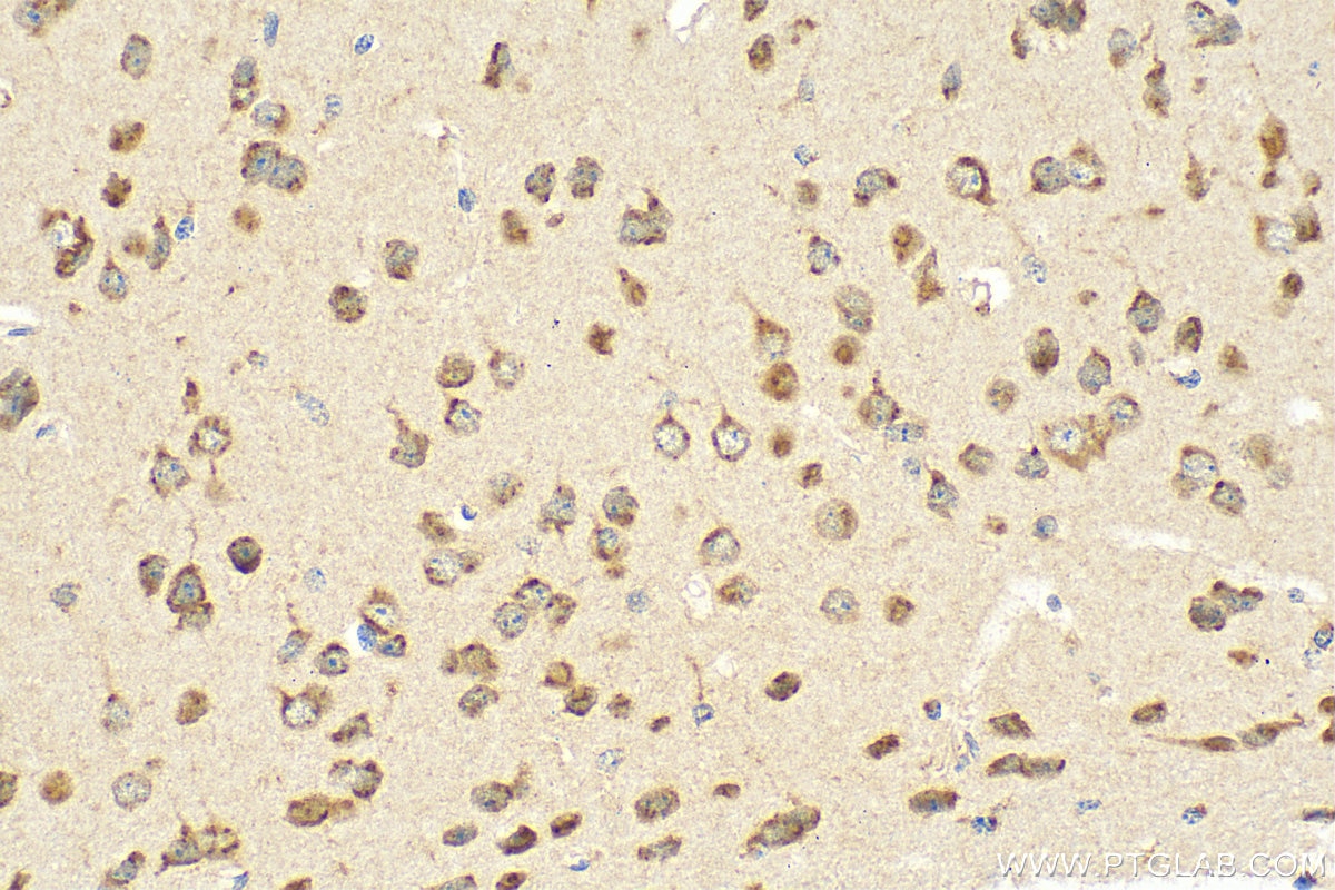 Immunohistochemistry (IHC) staining of mouse brain tissue using KIAA0319L Polyclonal antibody (21016-1-AP)