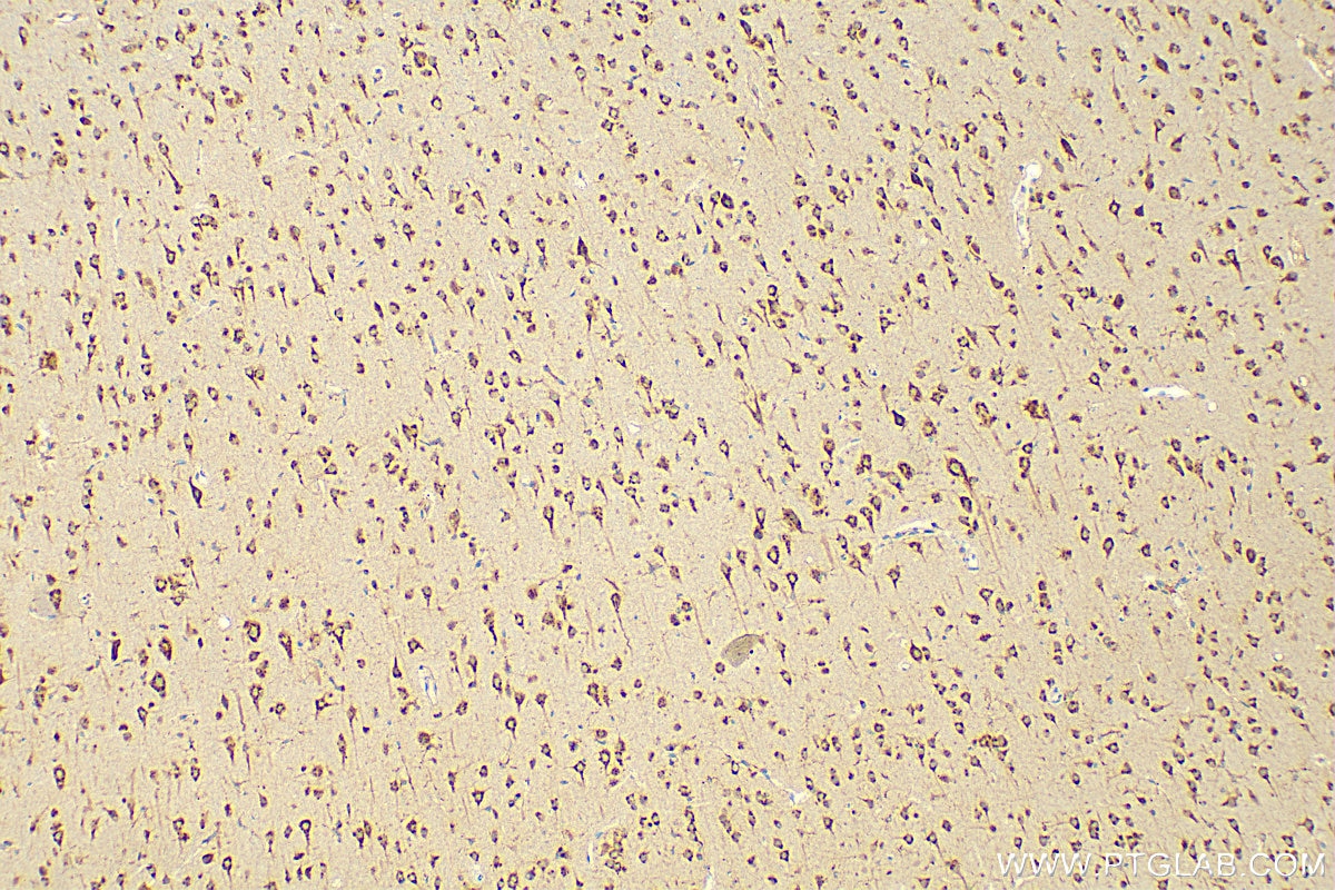 Immunohistochemistry (IHC) staining of rat brain tissue using KIAA0319L Polyclonal antibody (21016-1-AP)