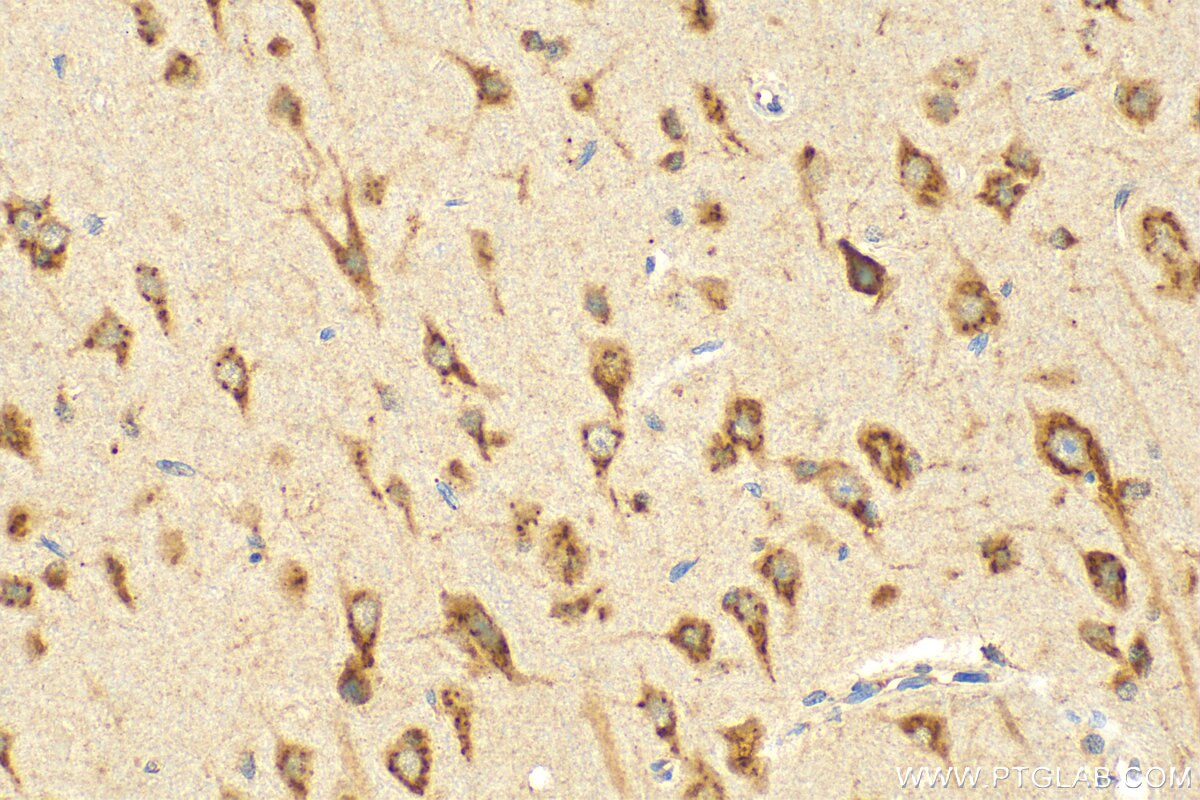 Immunohistochemistry (IHC) staining of rat brain tissue using KIAA0319L Polyclonal antibody (21016-1-AP)