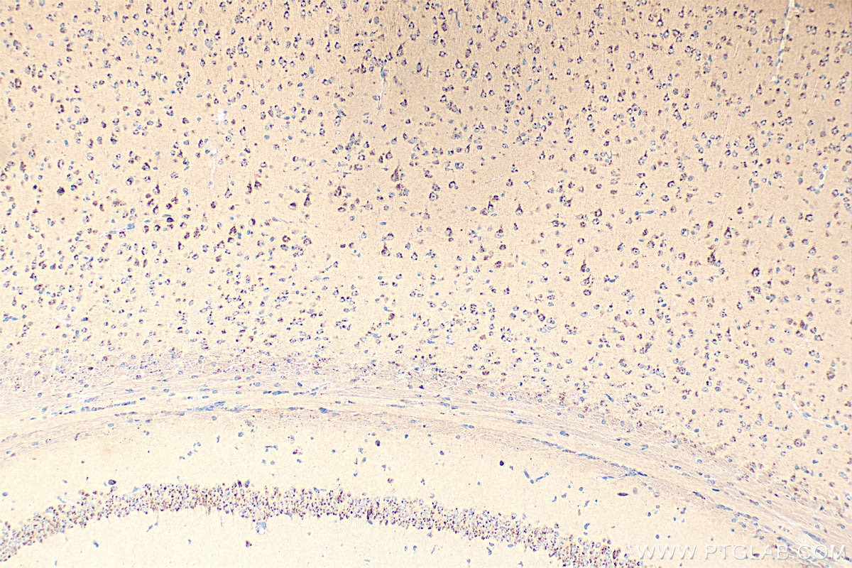 Immunohistochemistry (IHC) staining of mouse brain tissue using KIAA0319L Polyclonal antibody (21016-1-AP)