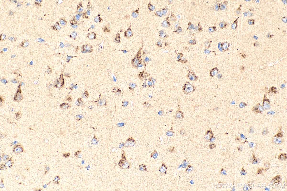Immunohistochemistry (IHC) staining of mouse brain tissue using KIAA0319L Polyclonal antibody (21016-1-AP)