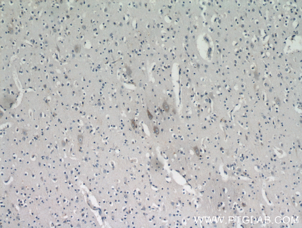 IHC staining of human brain using 21016-1-AP