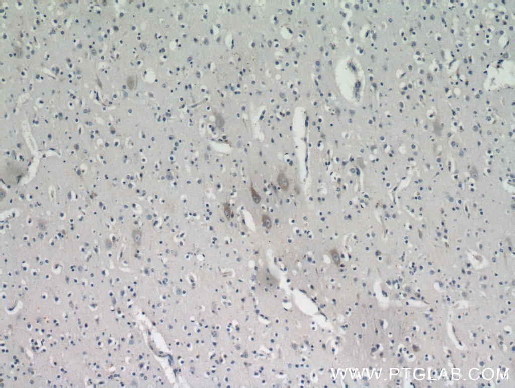 Immunohistochemistry (IHC) staining of human brain tissue using KIAA0319L Polyclonal antibody (21016-1-AP)