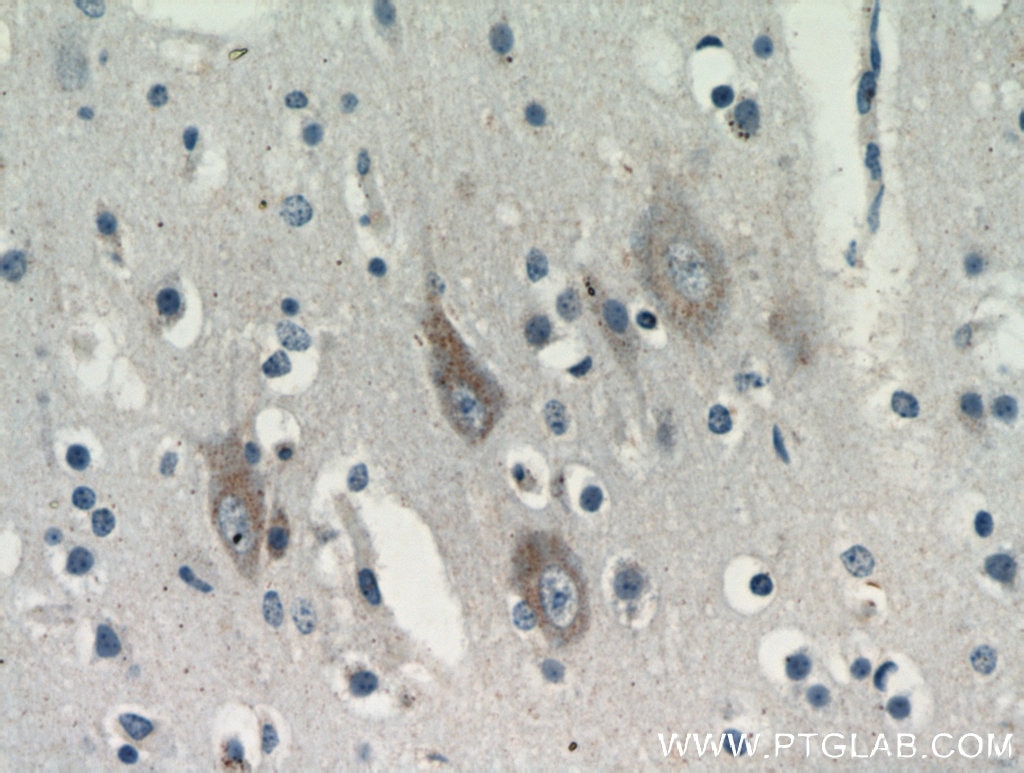 Immunohistochemistry (IHC) staining of human brain tissue using KIAA0319L Polyclonal antibody (21016-1-AP)