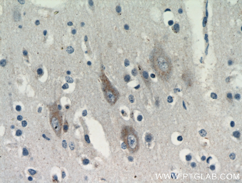 IHC staining of human brain using 21016-1-AP