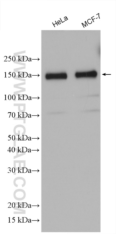 Western Blot (WB) analysis of various lysates using KIAA0319L Polyclonal antibody (21016-1-AP)