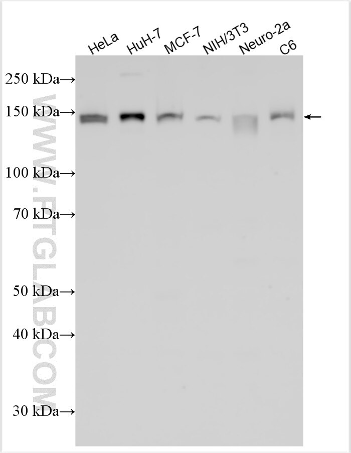 Western Blot (WB) analysis of various lysates using KIAA0319L Polyclonal antibody (21016-1-AP)