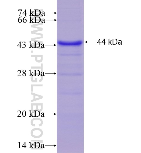 KIAA0319L fusion protein Ag15263 SDS-PAGE