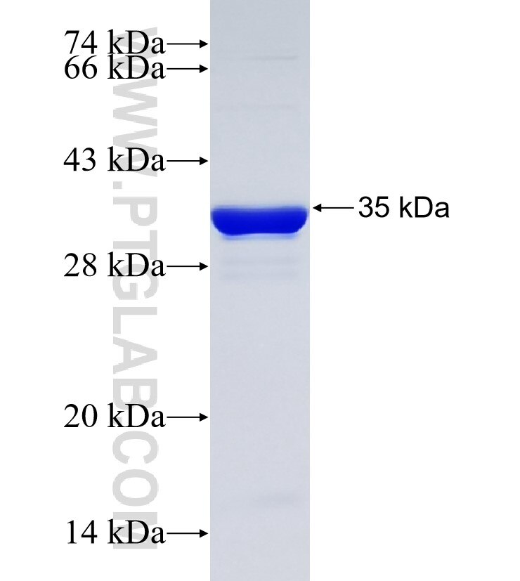 KIAA0323 fusion protein Ag35413 SDS-PAGE KIAA0323 fusion protein Ag35413 SDS-PAGE