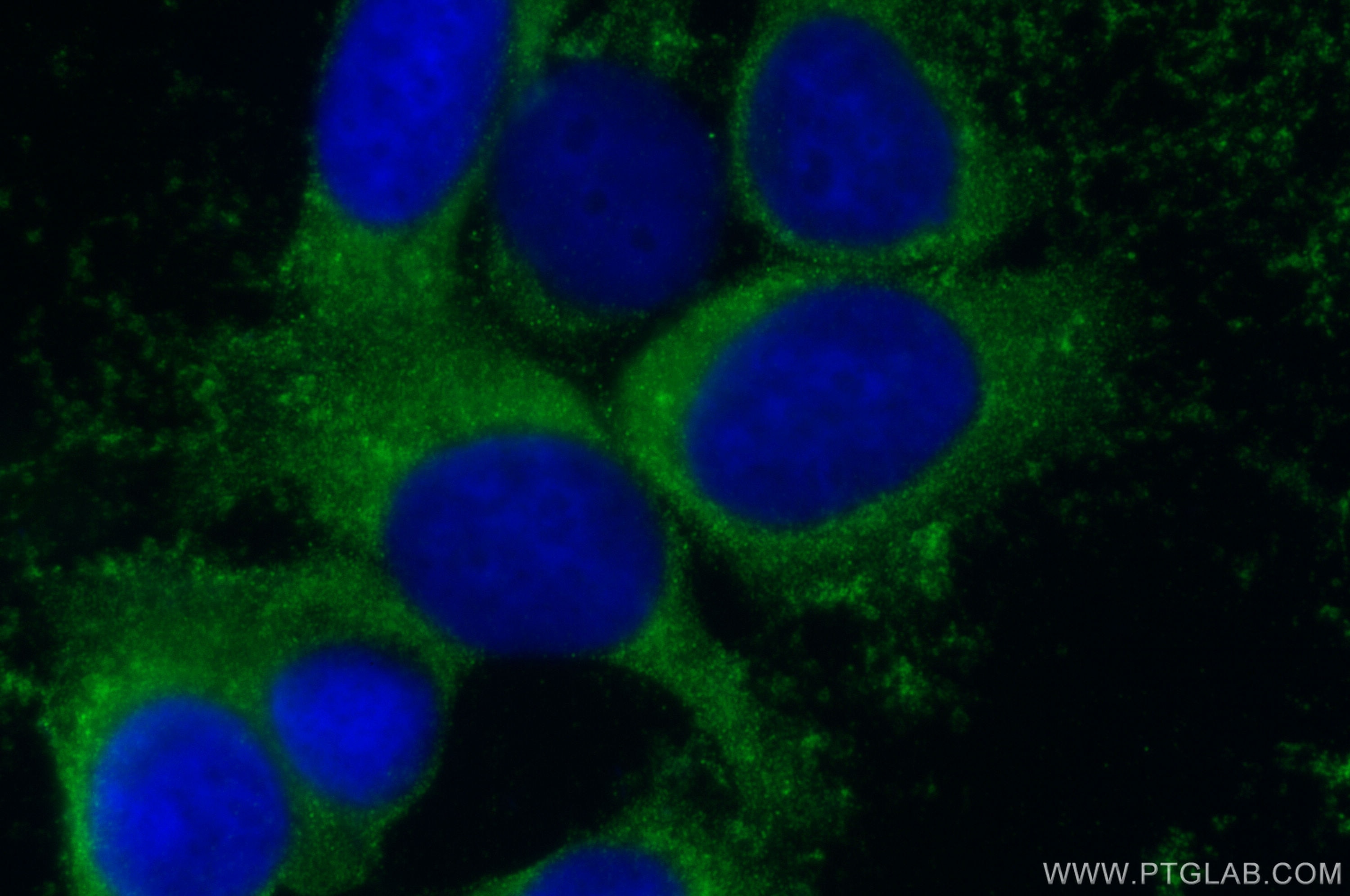 Immunofluorescence (IF) / fluorescent staining of MCF-7 cells using DYNC1H1 Polyclonal antibody (12345-1-AP)
