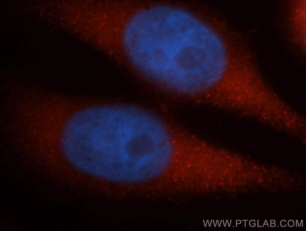 Immunofluorescence (IF) / fluorescent staining of MCF-7 cells using DYNC1H1 Polyclonal antibody (12345-1-AP)