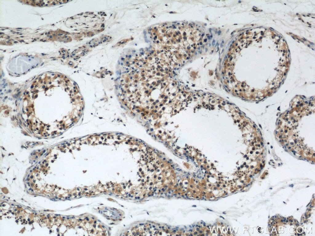 Immunohistochemistry (IHC) staining of human testis tissue using DYNC1H1 Polyclonal antibody (12345-1-AP)