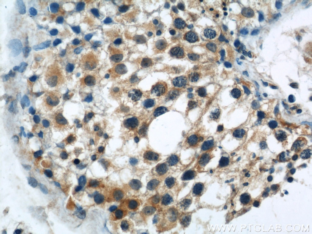 Immunohistochemistry (IHC) staining of human testis tissue using DYNC1H1 Polyclonal antibody (12345-1-AP)