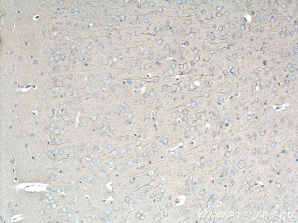 Immunohistochemistry (IHC) staining of mouse brain tissue using DYNC1H1 Polyclonal antibody (12345-1-AP)