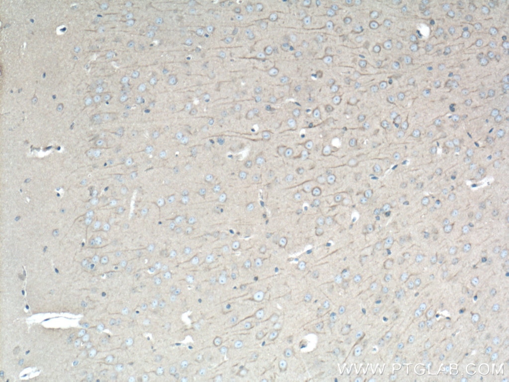 Immunohistochemistry (IHC) staining of mouse brain tissue using DYNC1H1 Polyclonal antibody (12345-1-AP)