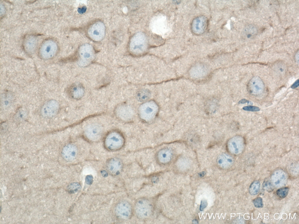 Immunohistochemistry (IHC) staining of mouse brain tissue using DYNC1H1 Polyclonal antibody (12345-1-AP)