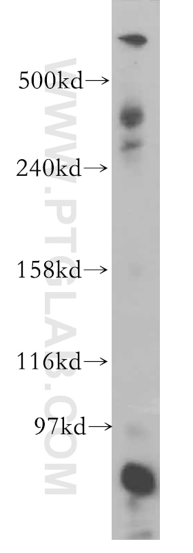 WB analysis of mouse brain using 12345-1-AP