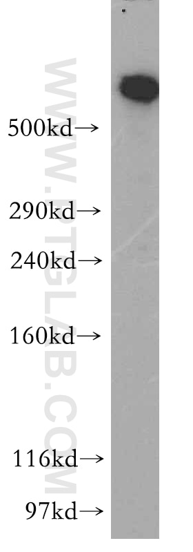 Western Blot (WB) analysis of human brain tissue using DYNC1H1 Polyclonal antibody (12345-1-AP)