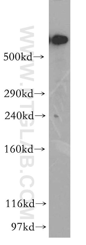 Western Blot (WB) analysis of human brain tissue using DYNC1H1 Polyclonal antibody (12345-1-AP)