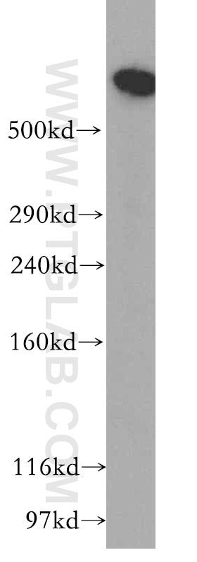 Western Blot (WB) analysis of HeLa cells using DYNC1H1 Polyclonal antibody (12345-1-AP)