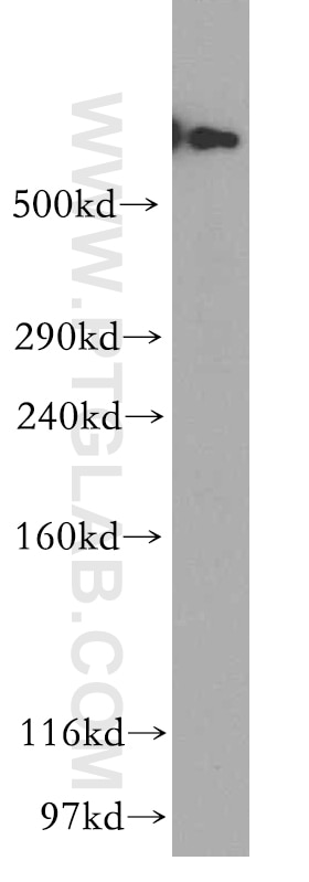 Western Blot (WB) analysis of HeLa cells using DYNC1H1 Polyclonal antibody (12345-1-AP)