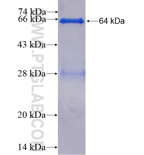 KIAA0325 fusion protein Ag2999 SDS-PAGE