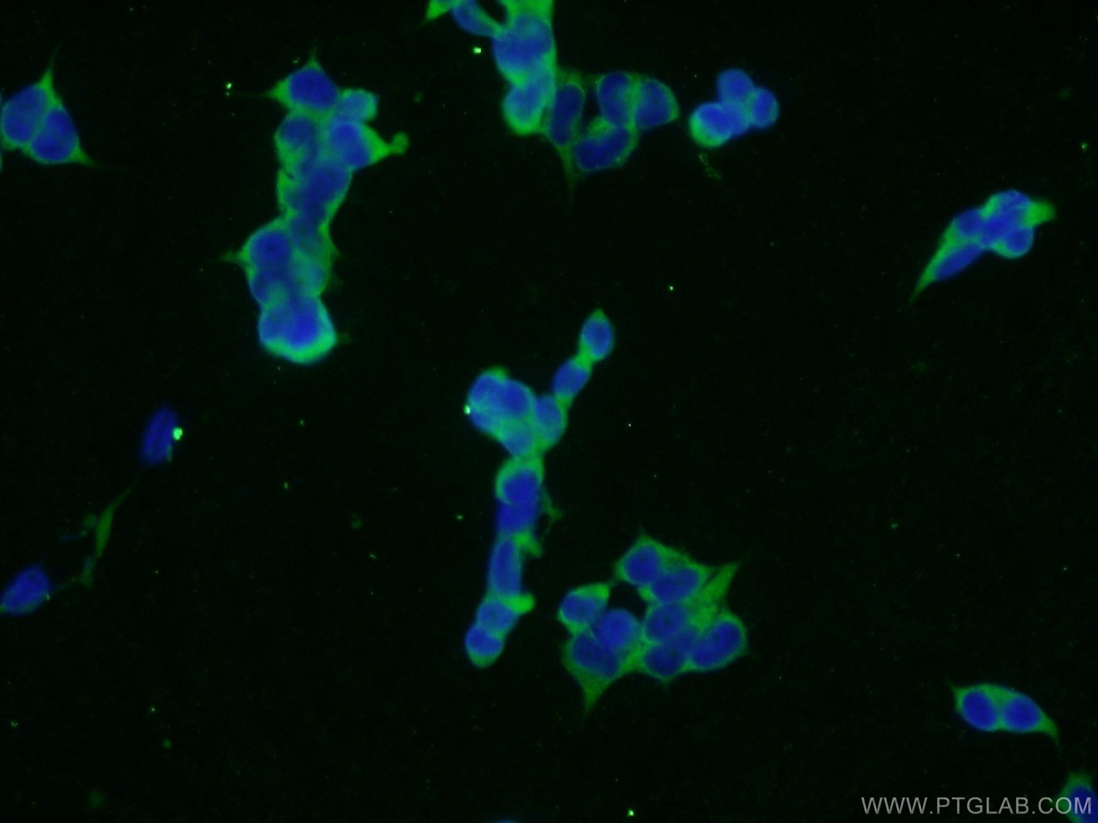 Immunofluorescence (IF) / fluorescent staining of HEK-293 cells using KIAA0368 Polyclonal antibody (25684-1-AP)