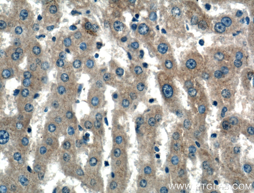 Immunohistochemistry (IHC) staining of human liver tissue using KIAA0368 Polyclonal antibody (25684-1-AP)