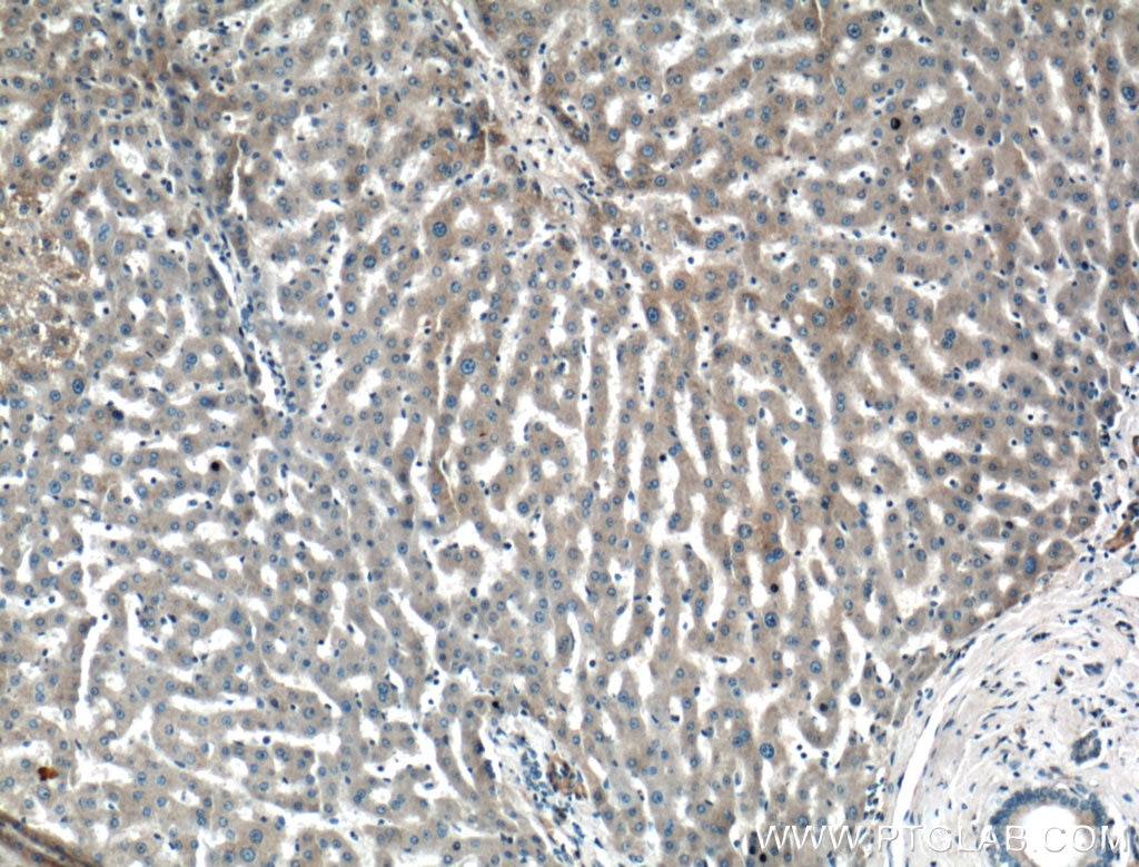 Immunohistochemistry (IHC) staining of human liver tissue using KIAA0368 Polyclonal antibody (25684-1-AP)