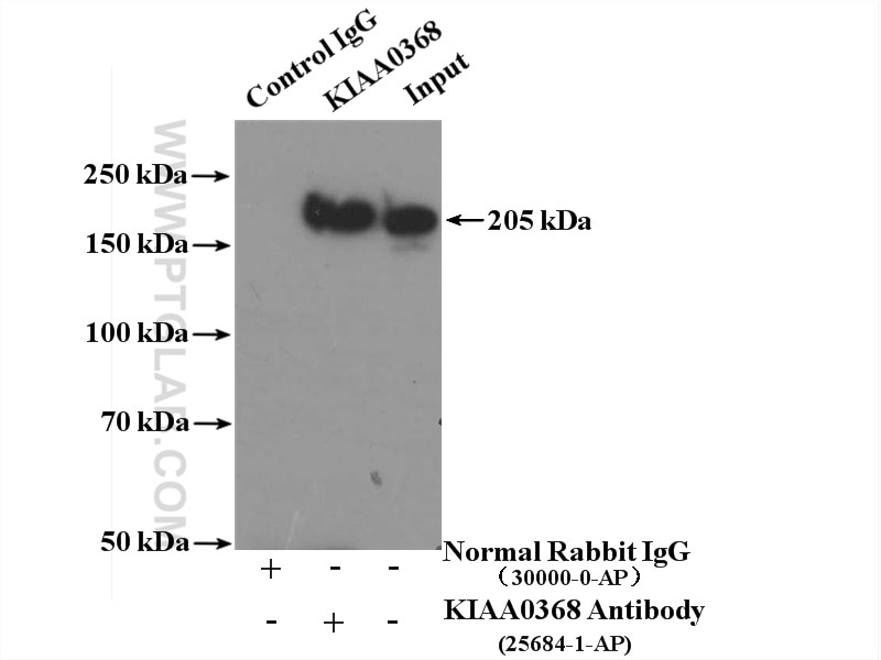 Immunoprecipitation (IP) experiment of HEK-293 cells using KIAA0368 Polyclonal antibody (25684-1-AP)