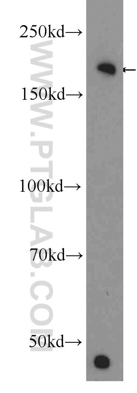 Western Blot (WB) analysis of A549 cells using KIAA0368 Polyclonal antibody (25684-1-AP)
