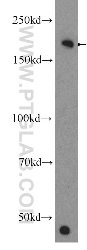 WB analysis of A549 using 25684-1-AP