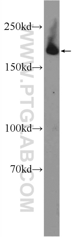 Western Blot (WB) analysis of HEK-293 cells using KIAA0368 Polyclonal antibody (25684-1-AP)