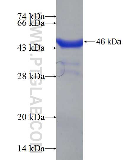 KIAA0368 fusion protein Ag22309 SDS-PAGE