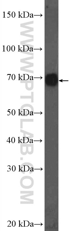 Western Blot (WB) analysis of mouse liver tissue using MRPP3 Polyclonal antibody (20959-1-AP)