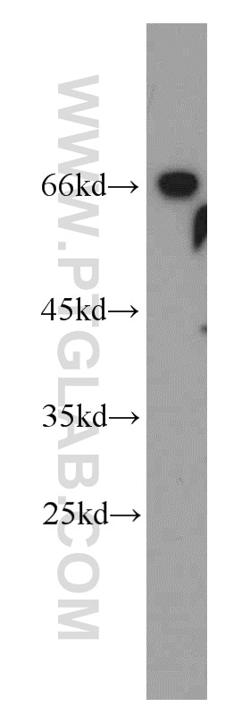 Western Blot (WB) analysis of mouse brain tissue using MRPP3 Polyclonal antibody (20959-1-AP)