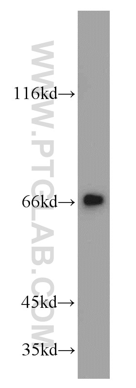Western Blot (WB) analysis of mouse brain tissue using MRPP3 Polyclonal antibody (20959-1-AP)