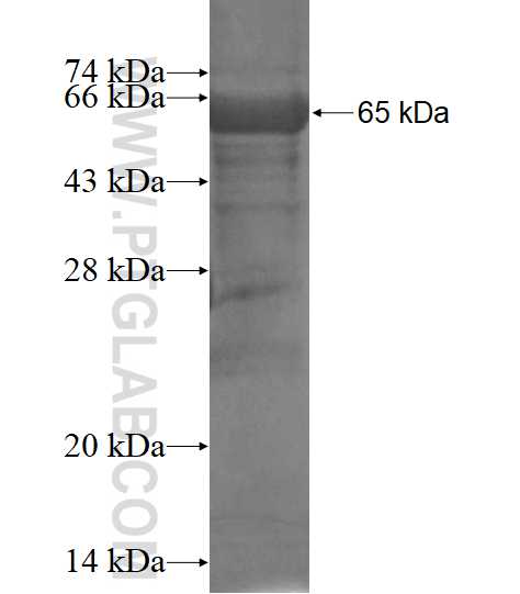 KIAA0391 fusion protein Ag15196 SDS-PAGE