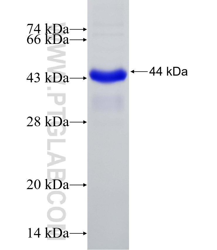 KIAA0391 fusion protein Ag15629 SDS-PAGE