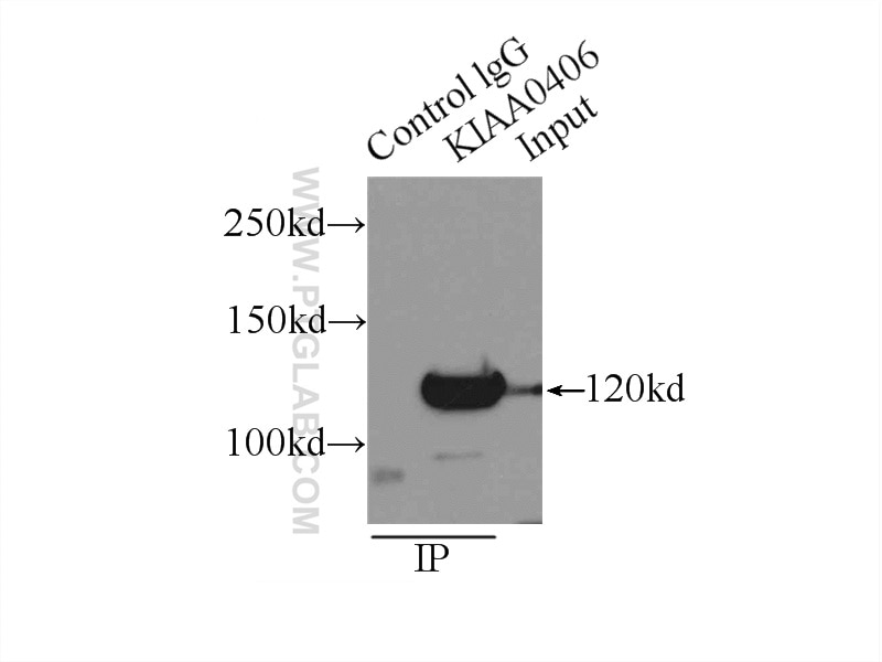 Immunoprecipitation (IP) experiment of HeLa cells using TTI1 Polyclonal antibody (22381-1-AP)