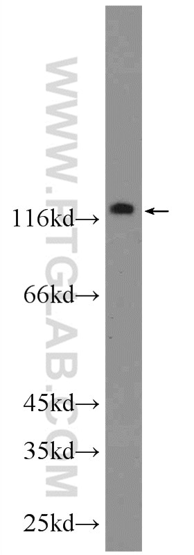Western Blot (WB) analysis of HeLa cells using TTI1 Polyclonal antibody (22381-1-AP)