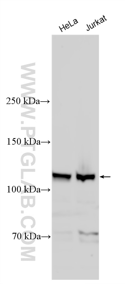 Various lysates were subjected to SDS PAGE followed by western blot with 22381-1-AP (TTI1 antibody) at dilution of 1:3000 incubated at room temperature for 1.5 hours. Western Blot (WB) analysis of various lysates using TTI1 Polyclonal antibody (22381-1-AP)