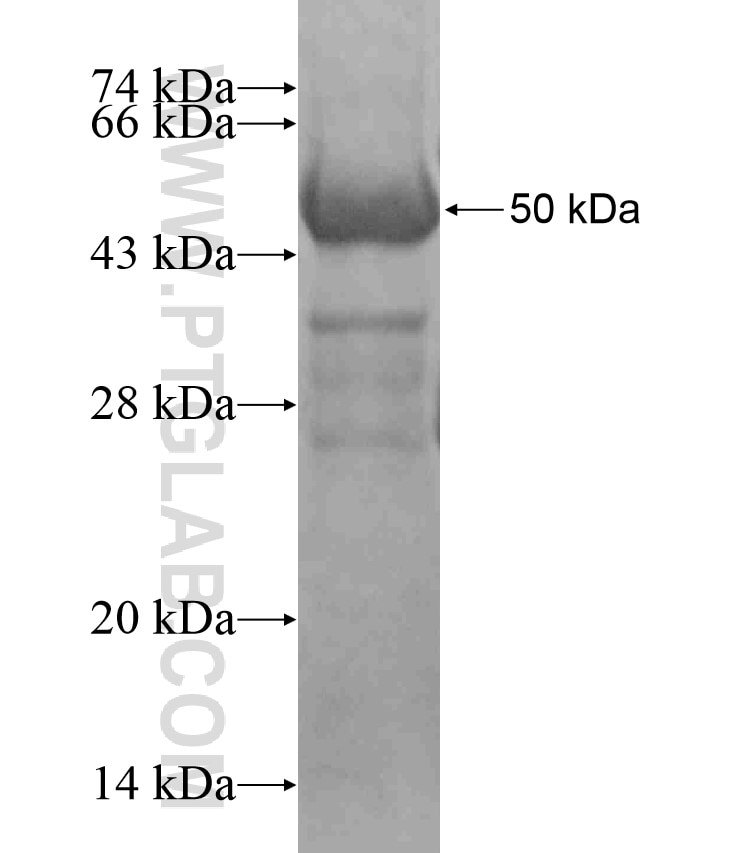 KIAA0406 fusion protein Ag17697 SDS-PAGE