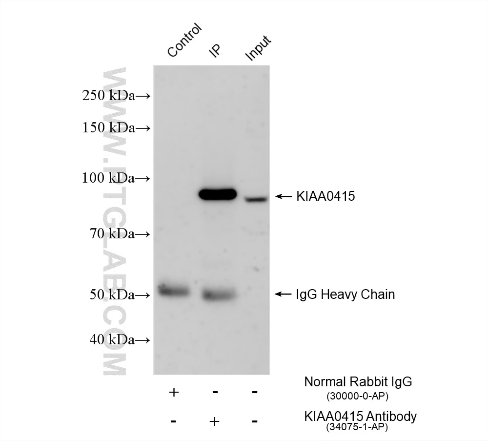 Immunoprecipitation (IP) experiment of HeLa cells using AP5Z1/SPG48 Polyclonal antibody (34075-1-AP)