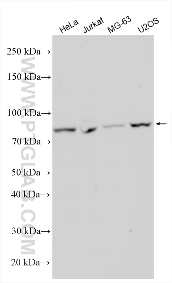 Western Blot (WB) analysis of various lysates using AP5Z1/SPG48 Polyclonal antibody (34075-1-AP)