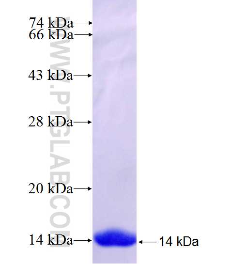 KIAA0415 fusion protein Ag26961 SDS-PAGE