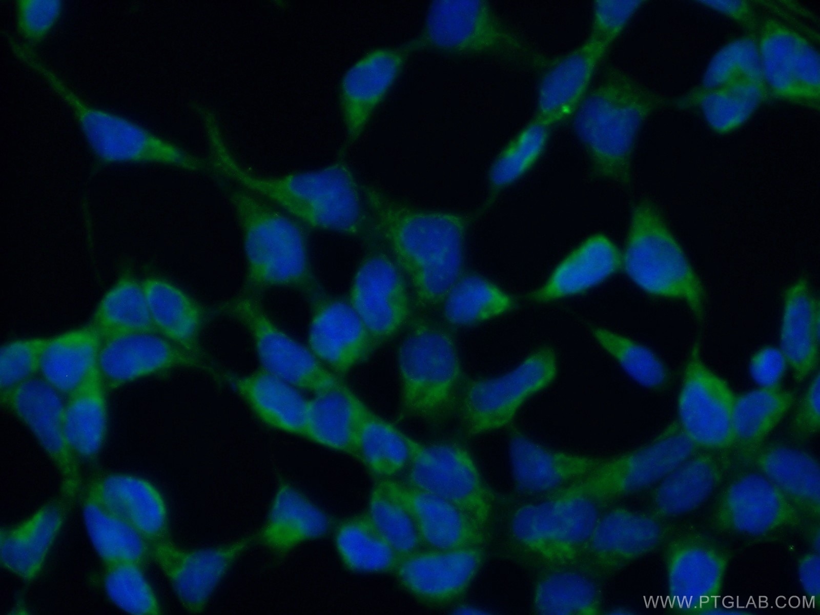 Immunofluorescence (IF) / fluorescent staining of HEK-293 cells using MARF1 Polyclonal antibody (25233-1-AP)